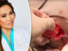 dr-pimple-popper-blackhead-pus-squeezing-900403