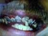 images_2017_Jay-Teeth-1-736×552-550×413